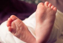 Muere tercer bebé con microcefalia en Honduras