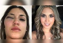 Colombia: Mujer golpeada por exnovio denuncia amenazas de familia del agresor