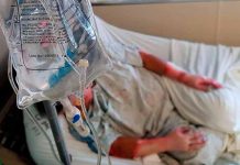 Honduras: Registran ingreso de madre e hija por quemaduras con pólvora