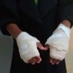 Brasil: Quemó las manos de su nieta en castigo por «mal comportamiento»