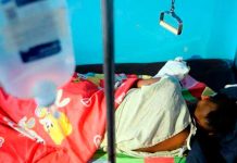 Honduras: Reportan 29 quemados en Nochebuena por manipular pólvora