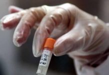 Epidemia de sarampión deja 17 muertos y miles de enfermos en Rumanía