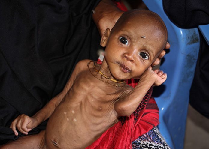 Somalia_rHOLYRt