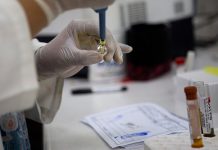 Confirman 54 casos de zika en Florida en 2017