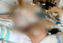 EE.UU: Adolescente sufre quemaduras al tratar de imitar video de TikTok estados unidos, adolescente, tiktok,
