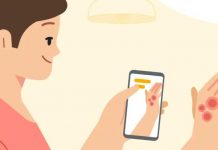 Presentan aplicación para identificar afecciones de la piel con la cámara tecnologia, ciencia, piel, google,