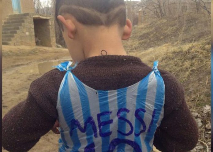 amessi