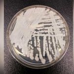 Aparece nuevo hongo resistente en hospitales de EEUU