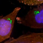 Bacterias que obstaculizan la quimioterapia