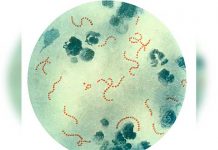 Mujer se contagia de la bacteria comecarne mientras practicaba sexo