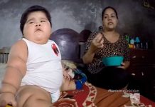 México: El insólito caso del bebé de 10 meses que pesa casi 30 kilogramos