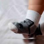 Bebé lloraba sin parar, le quitan calcetín y descubrieron lo peor