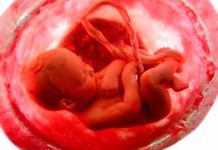 La sangre del cordón umbilical humano rejuvenece el cerebro