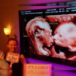 Ecografía 4D capta a gemelos dándose un beso