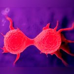 Hallaron la clave para detener la propagación del cáncer de mama