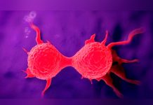 Hallaron la clave para detener la propagación del cáncer de mama