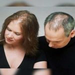 Científicos descubren células responsables de canas y calvicie