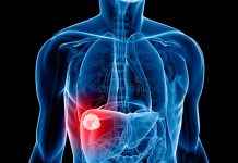 Crean por primera vez un modelo de tumor de hígado humano