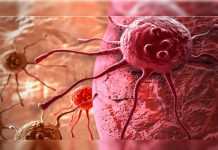 En 2030 habrá una muerte por cáncer cada dos segundos en el mundo
