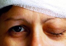 Zika puede combatir un tipo de cáncer cerebral, según estudio