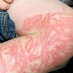 ‘Tiktoker’ lame una criatura «viscosa» sin darse cuenta de que es mortal tendencias, carabela portuguesa, criatura,