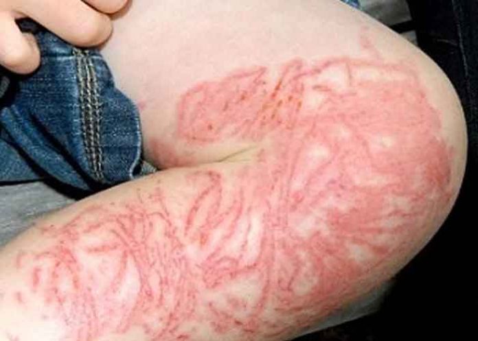 carabela tendencias, carabela portuguesa, criatura,