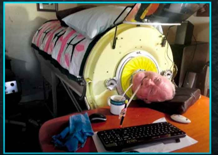 case-1 ciencia, pulmon de acero, salud,