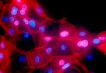 Errores en ADN contribuyen al cáncer, dicen científicos