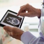 Estudio vincula riesgos de trastornos vasculares con enfermedad de Alzheimer