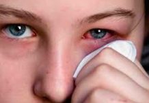6 efectivos remedios caseros para la conjuntivitis
