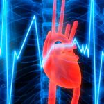 Inteligencia artificial logra predecir infartos