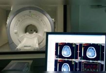 Desarrollan un nuevo modelo biológico para tratar el Alzheimer