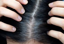 ¿Tienes canas prematuras? Puede ser alerta de una grave enfermedad