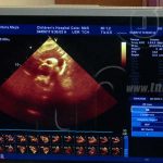 Jornada de ecocardiogramas a pacientes de La Mascota