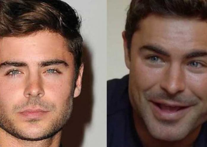 entretenimiento, zac efron, rostro,