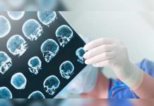 Cuáles son los deportes recomendados para pacientes con epilepsia