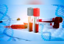 Hemofilia: cómo prevenir esta extraña enfermedad genética