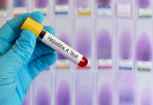 EEUU: 14 muertos desde enero por epidemia de hepatitis A en San Diego
