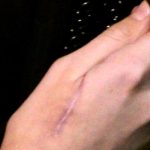 El reloj biológico marca el tiempo de regeneración de la piel