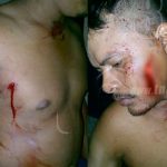 Un muerto y 3 heridos por apuñalamiento en Universidad de Texas