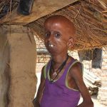 Video: joven de 21 años atrapado en el cuerpo de un anciano