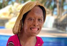 Juanita de 12 años denuncia brutales abusos en su hogar en México mexico, juanita, abusos, maltrato infantil,