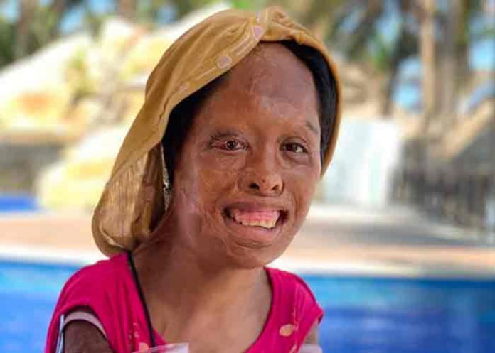 juanita- mexico, juanita, abusos, maltrato infantil,