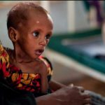 OMS: Aumenta el número de niños raquíticos en África