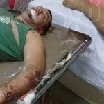 Conductor pierde el control de su vehículo y se estrella contra rastra en Santo Tomás