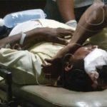 Motociclista lesionado al no guarda su distancia