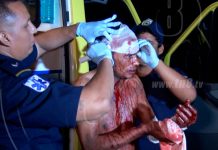 Hombre es macheteado por agredir a su exmujer