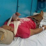 Rivas: Ciudadano casi pierde la mano mientras afilaba un machete