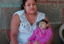 Diriamba: Niña con microcefalia necesita ayuda