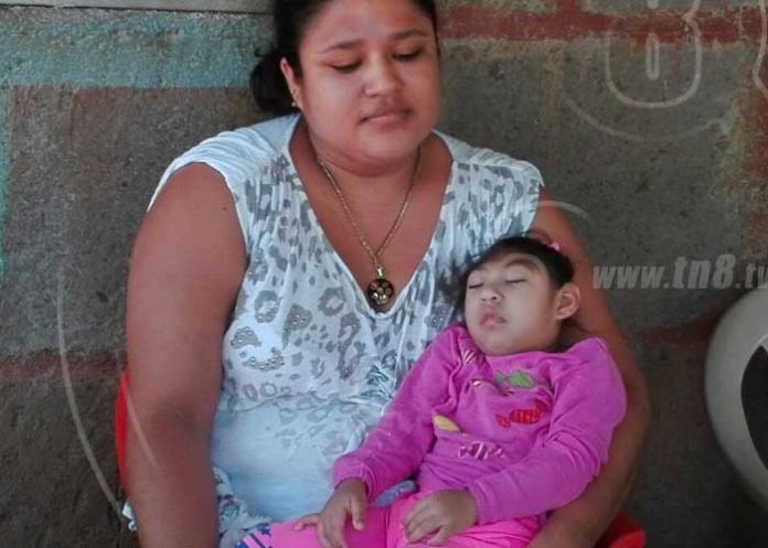 microcefaliacarazo1_H8T00QM